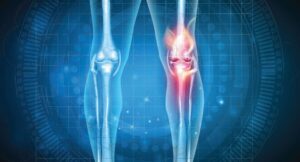 a graphic of two kneecaps