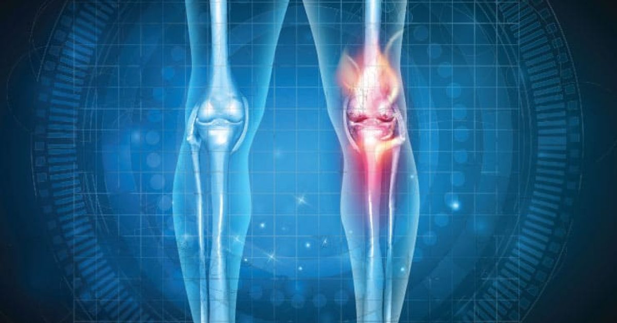 a graphic of two kneecaps